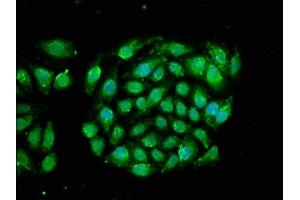Immunofluorescence staining of A549 cells with ABIN7167205 at 1:66, counter-stained with DAPI.