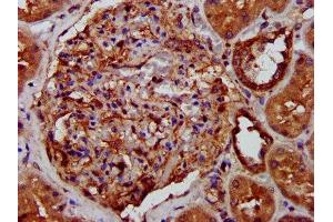 IHC image of ABIN7158045 diluted at 1:400 and staining in paraffin-embedded human kidney tissue performed on a Leica BondTM system.