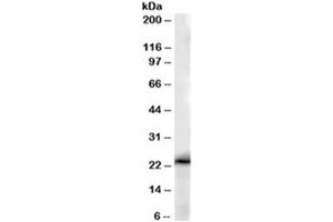 Western blot testing of human kidney lysate with GSTP1 antibody at 0. (GSTP1 anticorps)