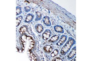 Anti-SSR3 antibody, IHC(P) IHC(P): Rat Intestine Tissue