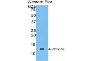 Detection of Recombinant PIGR, Bovine using Polyclonal Antibody to Polymeric Immunoglobulin Receptor (PIGR) (PIGR anticorps  (AA 461-560))
