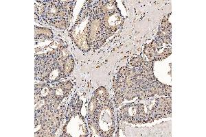 IHC analysis of SART1 using anti-SART1 antibody (ABIN7599884).