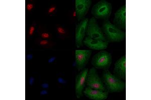 ABIN6259637 and ABIN6274424 staining  cells by IF/ICC. (CCAR2 anticorps  (Internal Region))