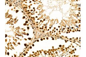 ABIN6258843 and ABIN6274212 at 1/100 staining Rat testis tissue by IHC-P. (HMGB2 anticorps  (Internal Region))