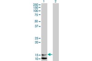 Western Blot analysis of NPPB expression in transfected 293T cell line by NPPB monoclonal antibody (M01), clone 2D11. (NPPB anticorps  (AA 1-134))