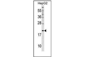 Western blot analysis of Cytoglobin (N-term) in HepG2 cell line lysates (35ug/lane).
