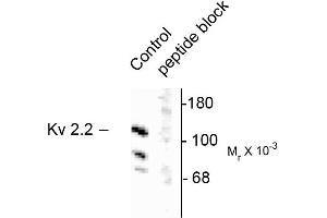 Western blots of rat brain homogenate showing specific immunolabeling of the ~125k voltage-gated potassium channel, Kv2. (Kv2.2 anticorps)