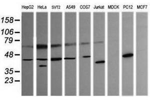Image no. 4 for anti-Parvin, alpha (PARVA) antibody (ABIN1496444)