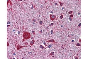 Immunohistochemistry (IHC) image for anti-Low Density Lipoprotein Receptor-Related Protein 8, Apolipoprotein E Receptor (LRP8) (Middle Region) antibody (ABIN2781990) (LRP8 anticorps  (Middle Region))