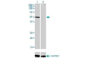 Western blot analysis of ZNF277 over-expressed 293 cell line, cotransfected with ZNF277 Validated Chimera RNAi (Lane 2) or non-transfected control (Lane 1). (ZNF277 anticorps  (AA 1-278))