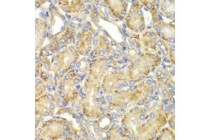 Immunohistochemistry of paraffin-embedded rat kidney using PP2A-B55α/PR55α/PPP2R2A antibody (ABIN3023153, ABIN3023154, ABIN3023155 and ABIN6219415) at dilution of 1:100 (40x lens).