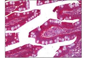 Immunohistochemistry (IHC) image for anti-Prune Exopolyphosphatase (PRUNE) antibody (ABIN954343)