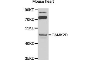 Western blot analysis of extracts of mouse heart, using CAMK2D antibody (ABIN1871415) at 1:1000 dilution. (CAMK2D anticorps)