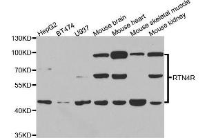 Western blot analysis of extracts of various cell lines, using RTN4R antibody (ABIN5973458) at 1/1000 dilution. (RTN4R anticorps)