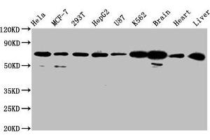 Western Blot Positive WB detected in: Hela whole cell lysate, MCF-7 whole cell lysate, 293T whole cell lysate, HepG2 whole cell lysate, U87 whole cell lysate, K562 whole cell lysate, Rat brain tissue, Mouse heart tissue, Mouse liver tissue All lanes: SLCO2A1 antibody at 2. (SLCO2A1 anticorps  (AA 416-518))
