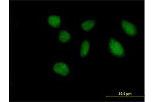 Immunofluorescence of purified MaxPab antibody to FAM47B on HeLa cell. (FAM47B anticorps  (AA 1-645))