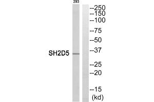 Western blot analysis of extracts from 293 cells, using SH2D5 antibody. (SH2D5 anticorps  (C-Term))