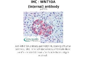 Image no. 1 for anti-Wingless-Type MMTV Integration Site Family, Member 10A (WNT10A) (Internal Region) antibody (ABIN1740818) (WNT10A anticorps  (Internal Region))