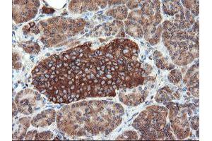 Image no. 5 for anti-Ubiquitin Specific Peptidase 9, X-Linked (USP9X) (AA 2246-2570) antibody (ABIN1491228) (USP9X anticorps  (AA 2246-2570))