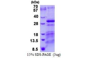 Image no. 1 for Charged Multivesicular Body Protein 5 (CHMP5) (AA 1-219) protein (His tag) (ABIN6387040)