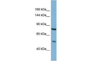 Host:  Rabbit  Target Name:  GALNT5  Sample Type:  COLO205 Whole Cell lysates  Antibody Dilution:  1. (GALNT5 anticorps  (C-Term))