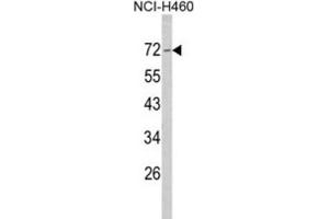 Western Blotting (WB) image for anti-Neurofibromin 2 (NF2) antibody (ABIN3002797) (Merlin anticorps)