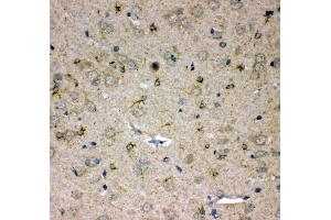 Anti-SPARCL1 antibody, IHC(P) IHC(P): Rat Brain Tissue (SPARCL1 anticorps  (C-Term))