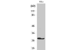 Western Blotting (WB) image for anti-Fas (TNFRSF6)-Associated Via Death Domain (FADD) (Tyr397) antibody (ABIN3175046) (FADD anticorps  (Tyr397))