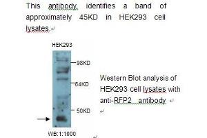 Image no. 1 for anti-Tripartite Motif Containing 13 (TRIM13) antibody (ABIN790828) (TRIM13 anticorps)
