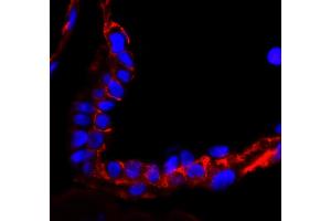 Immunofluorescence (IF) image for anti-Epidermal Growth Factor Receptor (EGFR) (C-Term) antibody (ABIN7448958) (EGFR anticorps  (C-Term))