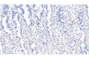 Detection of LSR in Human Stomach Tissue using Monoclonal Antibody to Lipolysis Stimulated Lipoprotein Receptor (LSR)