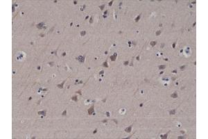 IHC testing of formalin fixed and paraffin embedded human brain tissue with recombinant LC3B antibody at 1:200 dilution.