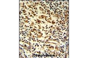 Formalin-fixed and paraffin-embedded human lymph reacted with HMHA1 Antibody (Center), which was peroxidase-conjugated to the secondary antibody, followed by DAB staining.