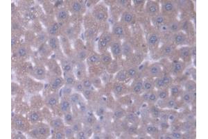 DAB staining on IHC-P; Samples: Mouse Liver Tissue (Acyl-CoA Dehydrogenase, C-4 To C-12 Straight Chain (ACADM) (AA 131-421) anticorps)