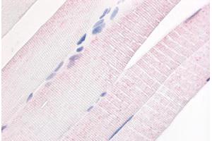 Human Skeletal Muscle (formalin-fixed, paraffin-embedded) stained with PDE7A antibody ABIN213530 at 20 ug/ml followed by biotinylated goat anti-rabbit IgG secondary antibody ABIN481713, alkaline phosphatase-streptavidin and chromogen.