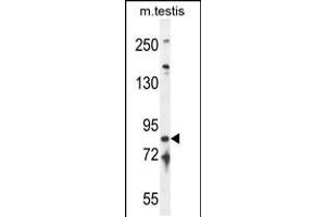 Western blot analysis in mouse testis tissue lysates (35ug/lane). (IFT81 anticorps  (C-Term))