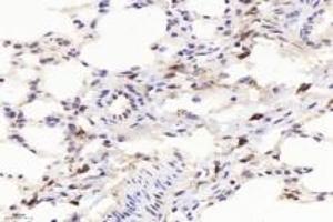 Immunohistochemistry of paraffin embedded mouse lung using F480 (ABIN7073801) at dilution of 1:1000 (400x lens) (F4/80 anticorps)