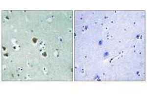 Immunohistochemistry analysis of paraffin-embedded human brain tissue using CRMP-2 (Ab-509) antibody.
