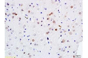 Formalin-fixed and paraffin embedded rat brain labeled with Anti DENTT Polyclonal Antibody, Unconjugated  at 1:200 followed by conjugation to the secondary antibody and DAB staining (TSPY-Like 2 anticorps  (AA 251-350))