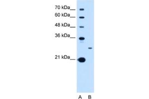 Western Blotting (WB) image for anti-Tetraspanin 15 (TSPAN15) antibody (ABIN2463029) (Tetraspanin 15 anticorps)