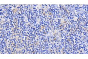 Detection of GAL1 in Bovine Lymph node Tissue using Polyclonal Antibody to Galectin 1 (GAL1)