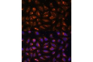 Immunofluorescence analysis of U-2 OS cells using CKMT1B Polyclonal Antibody (ABIN3017245, ABIN3017246, ABIN3017247 and ABIN6220012) at dilution of 1:100 (40x lens).