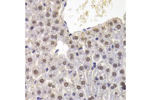 Immunohistochemistry of paraffin-embedded mouse liver using PRDM5 antibody at dilution of 1:100 (x400 lens).