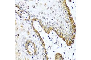 Immunohistochemistry of paraffin-embedded human esophagus using VIP antibody at dilution of 1:100 (40x lens). (Vip anticorps)