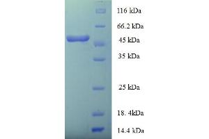 SDS-PAGE (SDS) image for HLA Class I Histocompatibility Antigen, alpha Chain E (HLA-E) (AA 22-305) protein (His-SUMO Tag) (ABIN5710770) (HLA-E Protein (AA 22-305) (His-SUMO Tag))