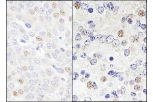 anti-DEAD (Asp-Glu-Ala-Asp) Box Polypeptide 46 (DDX46) (AA 300-350) antibody