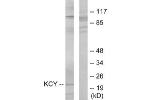 Western blot analysis of extracts from HeLa cells, using KCY antibody. (KCY (N-Term) anticorps)