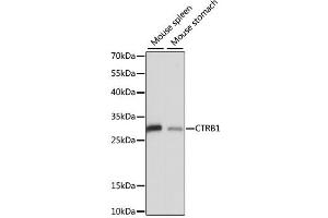 Western blot analysis of extracts of various cell lines, using CTRB1 antibody. (CTRB1 anticorps)