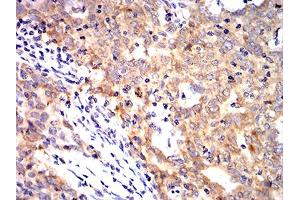 Immunohistochemistry (IHC) image for anti-Keratin 10 (KRT10) (AA 345-454) antibody (ABIN5888939) (Keratin 10 anticorps  (AA 345-454))