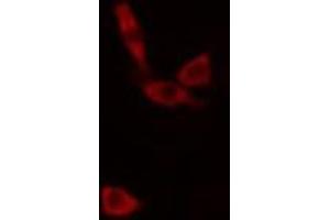 ABIN6266813 staining K-562 cells by IF/ICC. (AGPAT9 anticorps  (Internal Region))